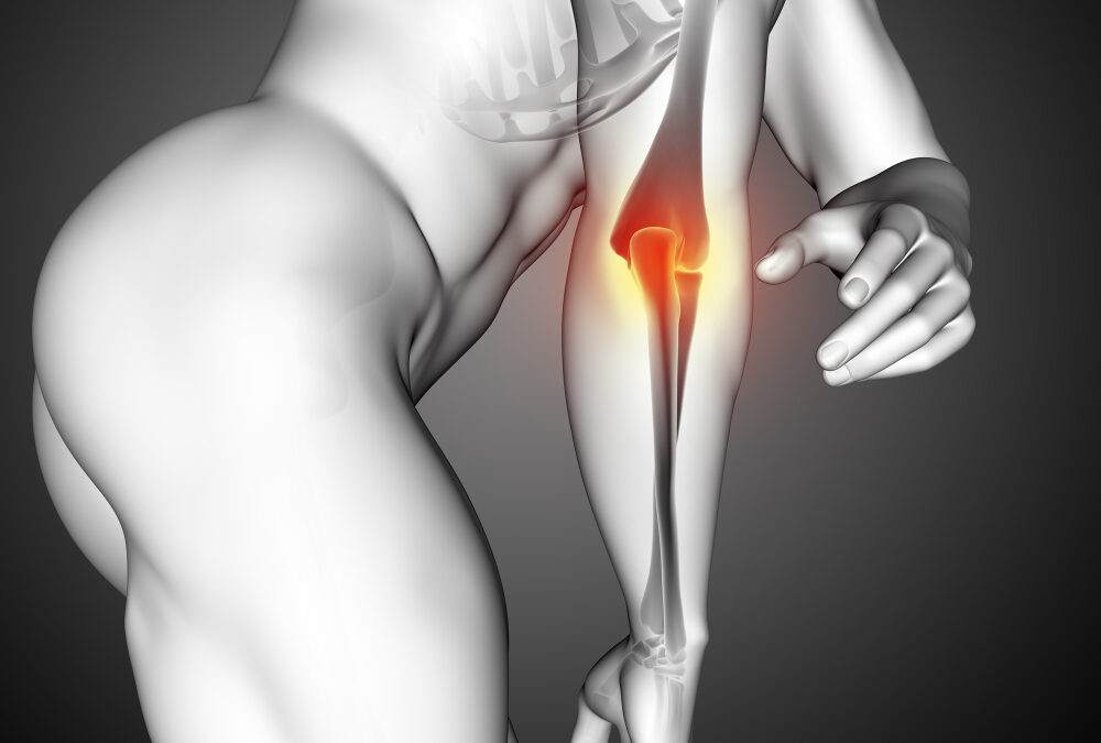 Staw łokciowy – anatomia, funkcjonalność i diagnostyka urazów
